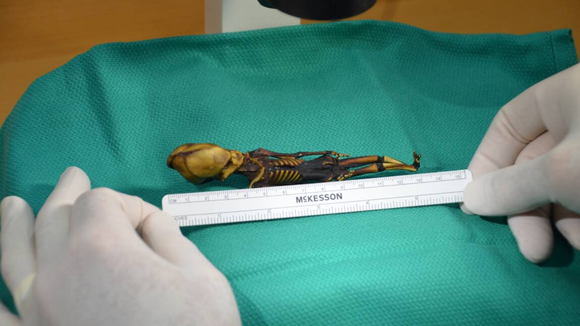 Le squelette du désert d'Atacama était une fille