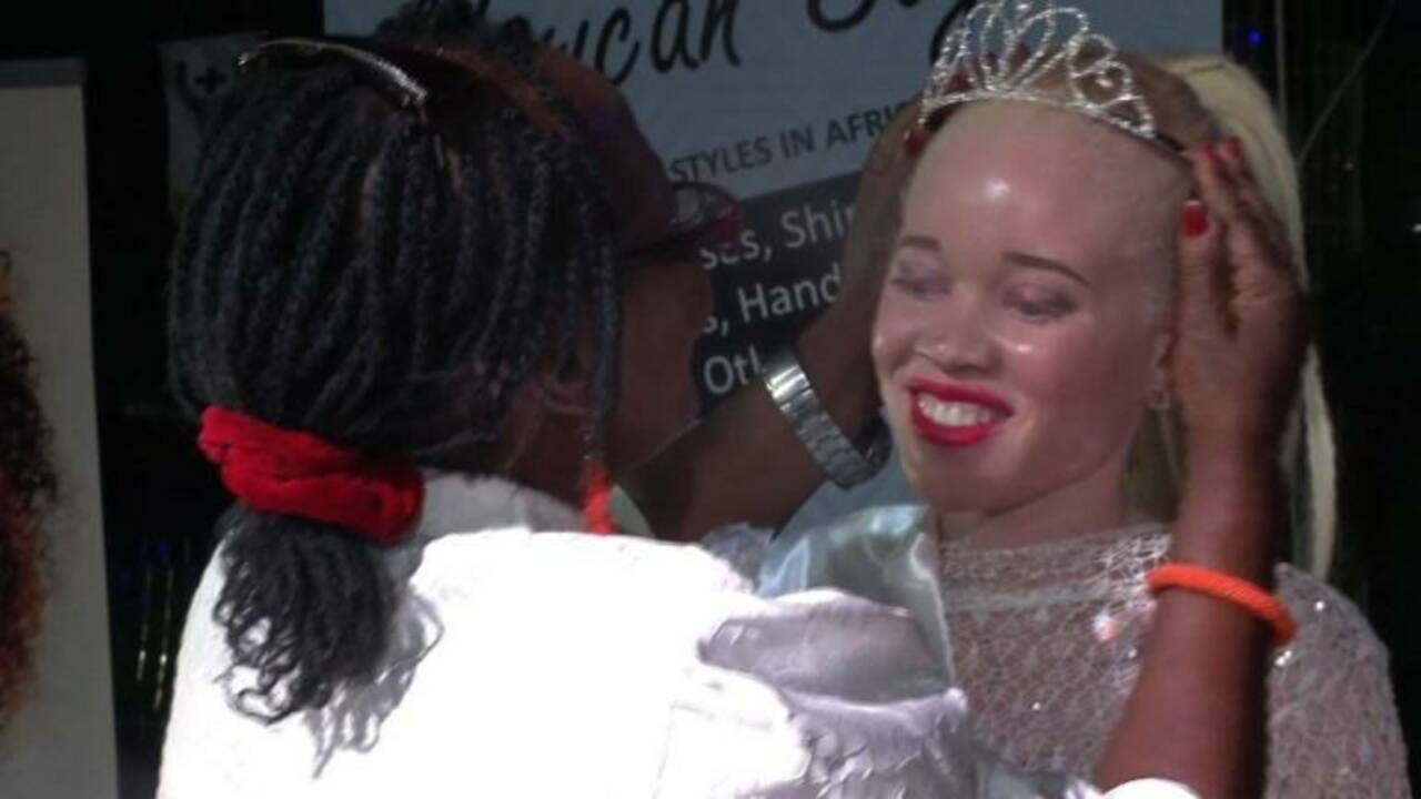 L'élection de Miss albinos à Harare, un concours anti-préjugés