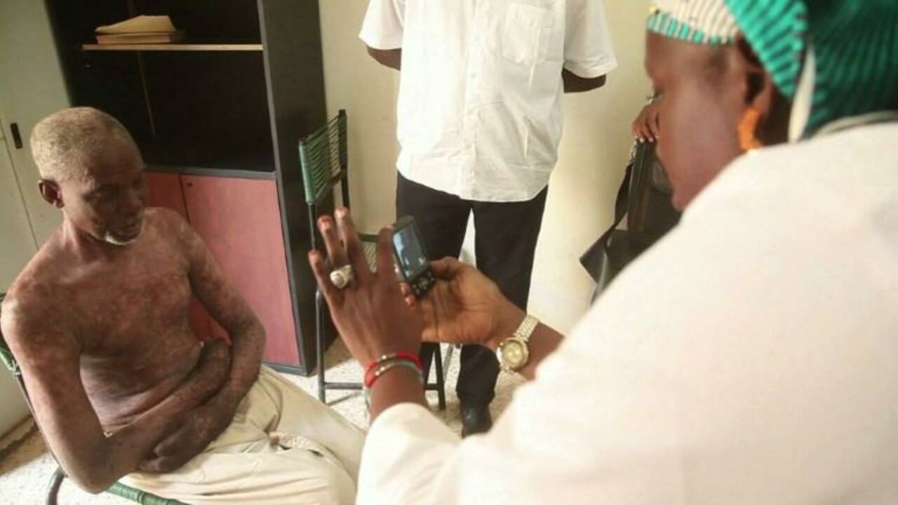 Mali:la télédermatologie rapproche les patients des spécialistes