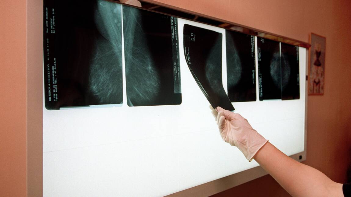 Cancer du sein: certains polluants favoriseraient les métastases