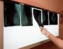 Cancer du sein: certains polluants favoriseraient les métastases