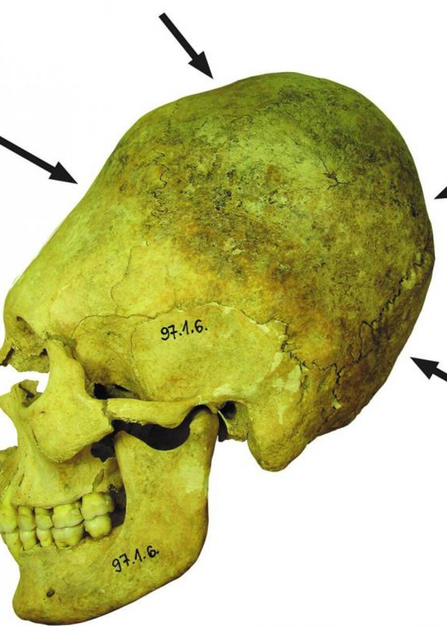Des crânes déformés livrent un aperçu des communautés pendant la chute de l'empire romain