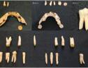En Pologne, des analyses de dents vieilles de 9000 ans révèlent les secrets de l’alimentation des chasseurs-cueilleurs