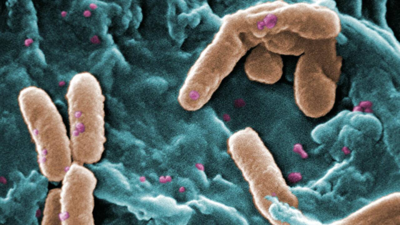 Quelle est la différence entre une bactérie et un virus ?
