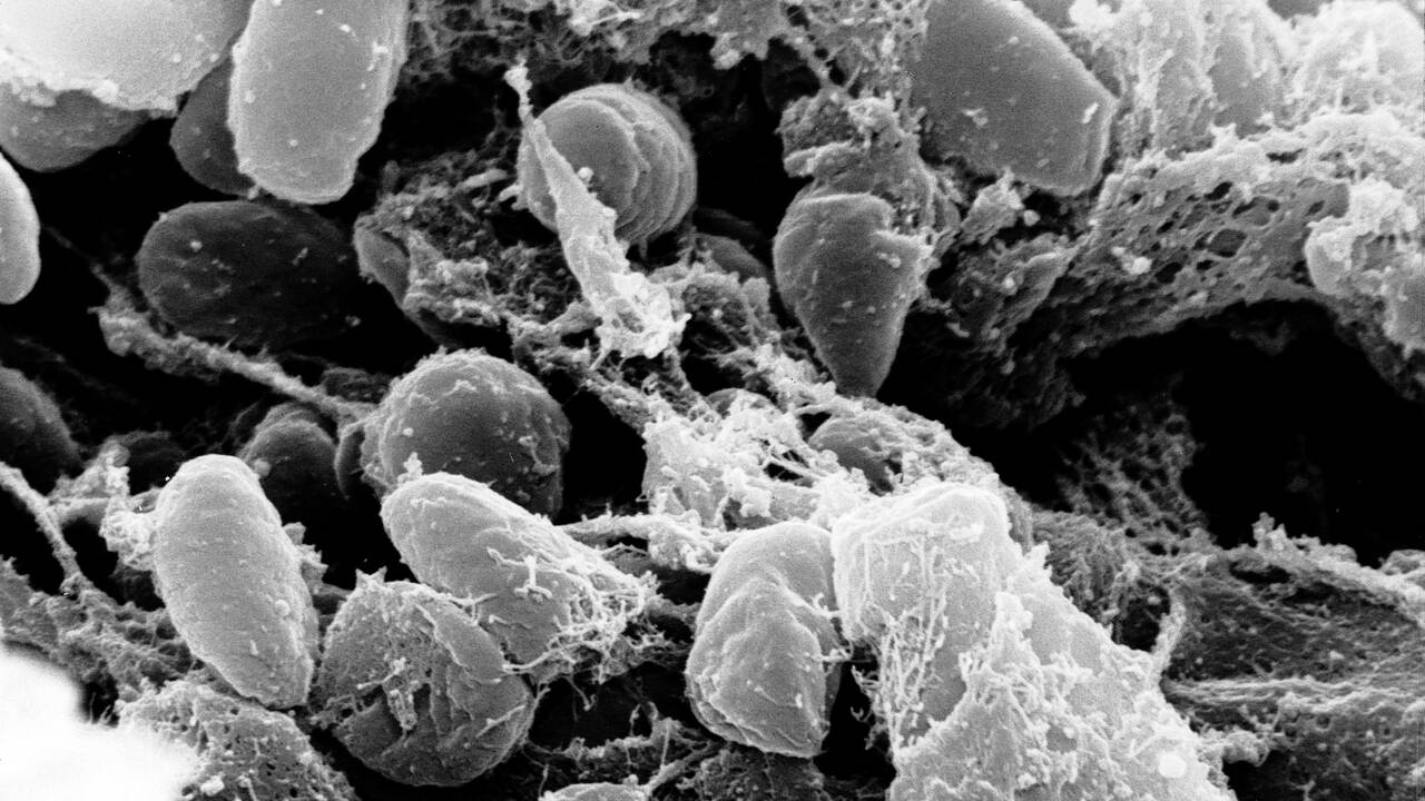 Peste noire : après des siècles de mystère, des chercheurs pensent avoir trouvé d'où elle venait