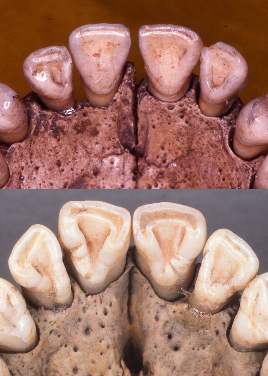 Une analyse de dents bouscule une théorie répandue sur l'origine des premiers Américains 
