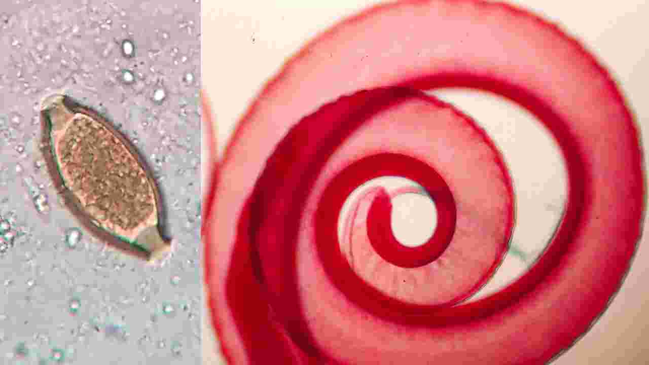 Le génome de l'un des plus anciens parasites affectant les humains reconstruit grâce à des excréments vikings