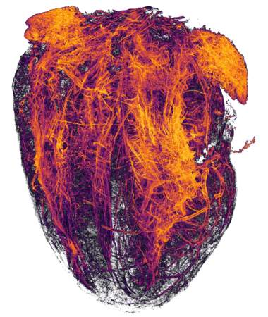 20.  Les vaisseaux sanguins d'un coeur de souris après un infarctus, grossis 2 fois. 