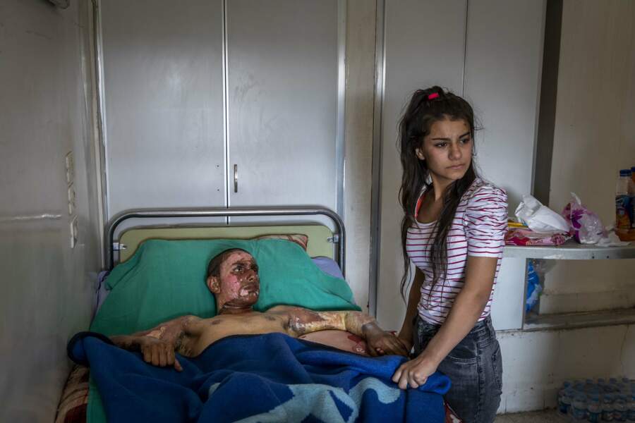 Un jeune combattant kurde gravement brûlé lors d'une bataille avec les forces turques à la frontière syro-turque - Catégories "Photo de l'année" et "Infos générales" (série)